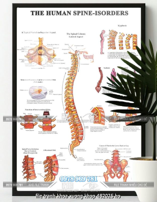 file tranh khoa xuong khop 482025 ho