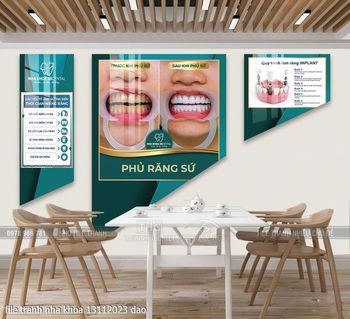 file tranh nha khoa 13112023 dao