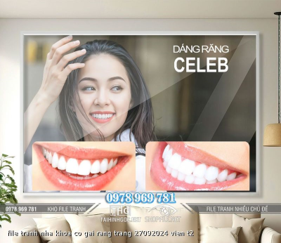 file tranh nha khoa co gai rang trang 27092024 vien t2