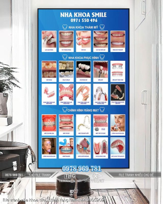 file tranh nha khoa dieu chinh rang ham mat 04052024