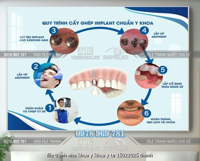 file tranh nha khoa y khoa y te 15022025 thanh