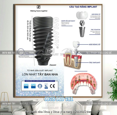 file tranh nha khoa y khoa y te rang 15022025 tien
