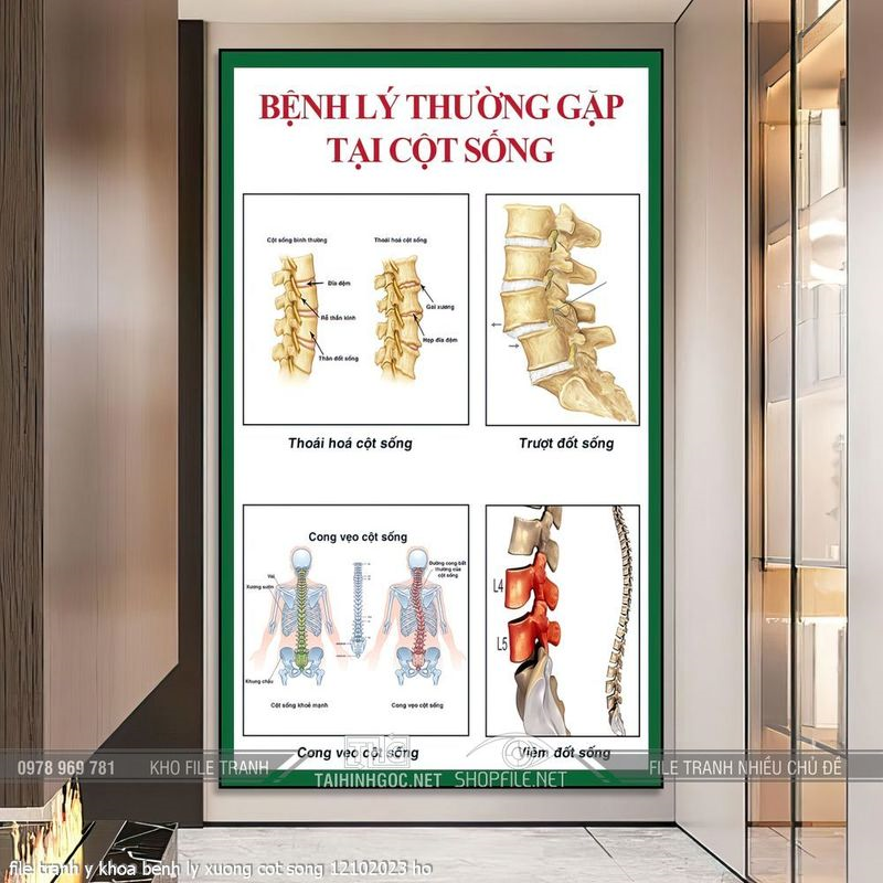 file tranh y khoa benh ly xuong cot song 12102023 ho