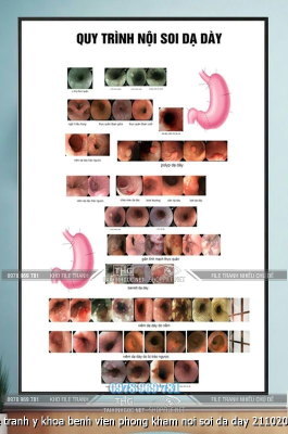 file tranh y khoa benh vien phong kham noi soi da day 21102025