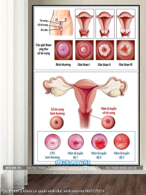 file tranh y khoa co quan sinh duc sinh san nu 06072024