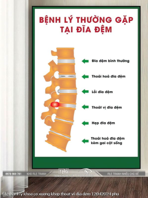 file tranh y khoa co xuong khop thoat vi dia dem 12042024 phu