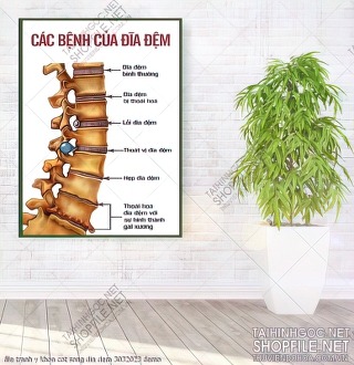 file tranh y khoa cot song dia dem 3032023