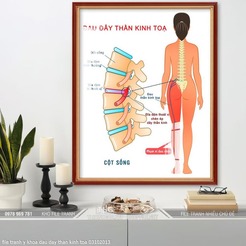 file tranh y khoa dau day than kinh toa 03102013