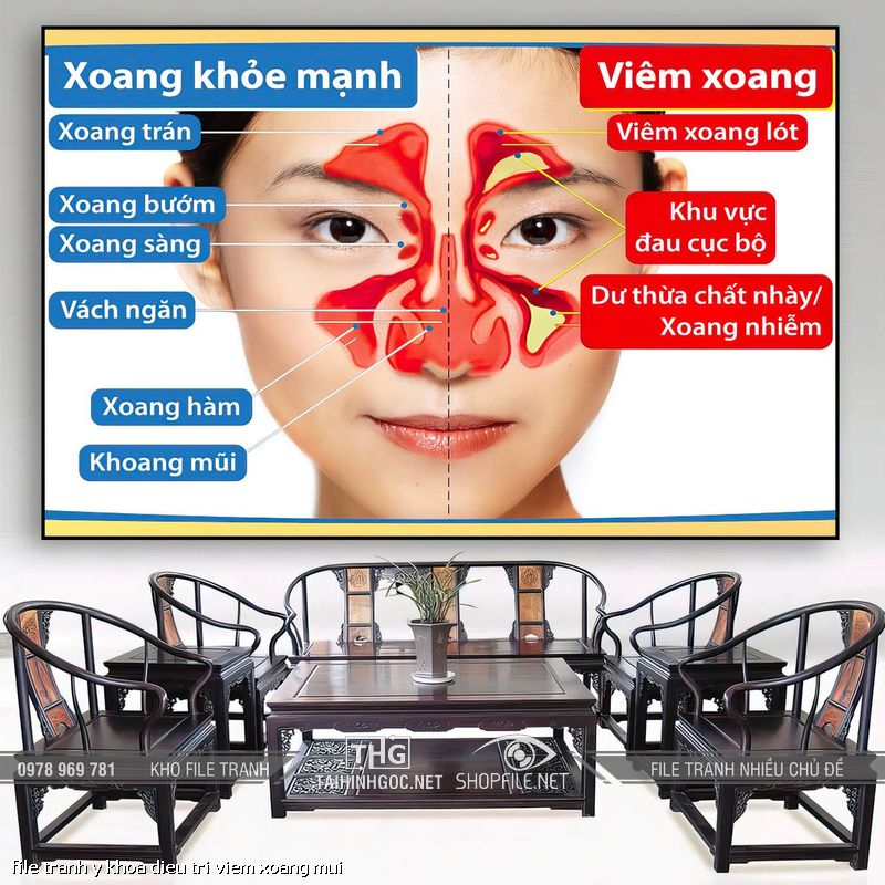 file tranh y khoa dieu tri viem xoang mui