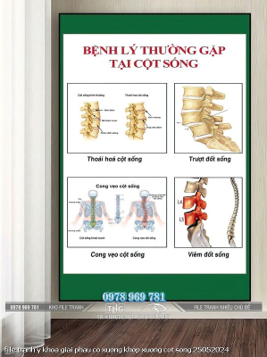 file tranh y khoa giai phau co xuong khop xuong cot song 25052024