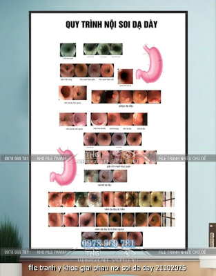 file tranh y khoa giai phau noi soi da day 21102025