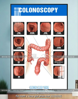 file tranh y khoa giai phau ruot 21102025