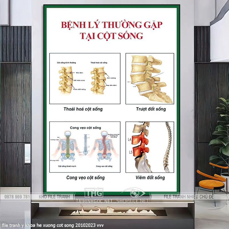 file tranh y khoa he xuong cot song 20102023 vvv