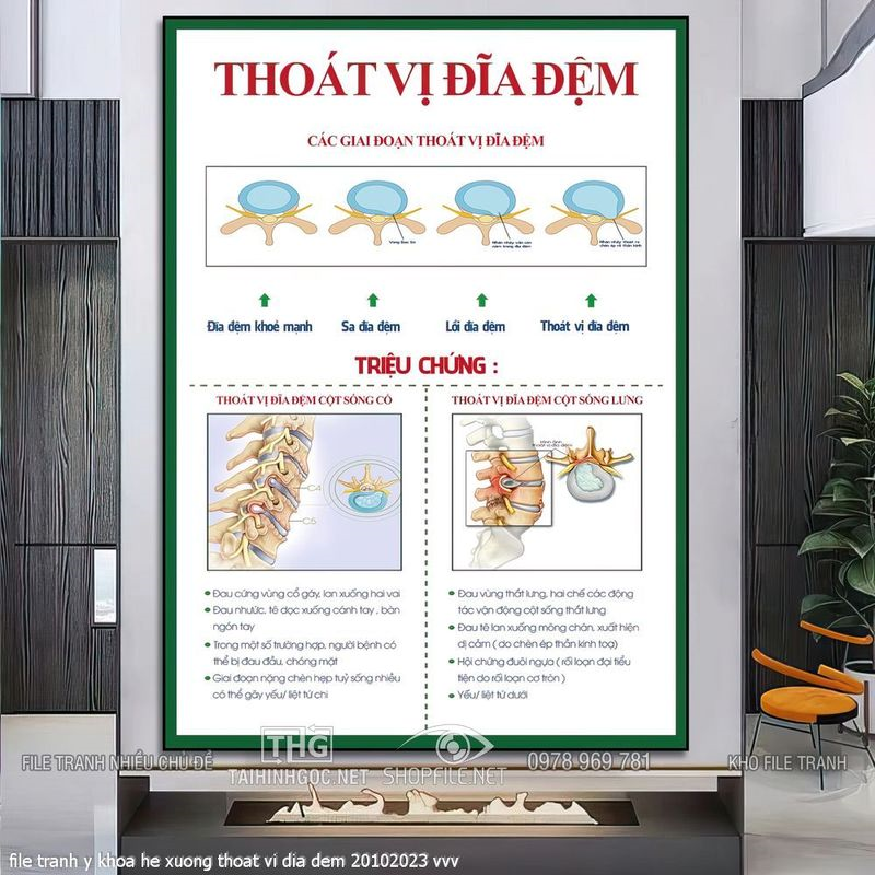 file tranh y khoa he xuong thoat vi dia dem 20102023 vvv