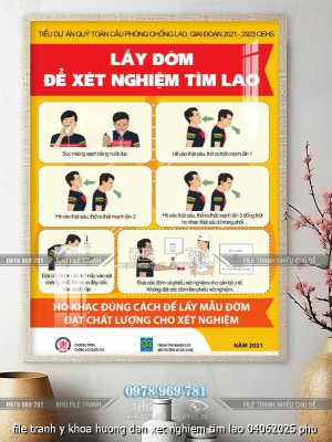file tranh y khoa huong dan xet nghiem tim lao 04062025 phu