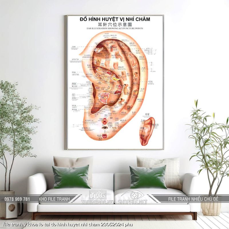 file tranh y khoa lo tai do hinh huyet nhi cham 23052024 phu