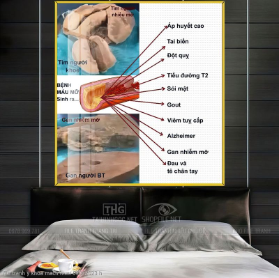 file tranh y khoa mach mau 09062023 h