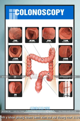 file tranh y khoa phong kham benh vien noi soi duong ruot 21102025
