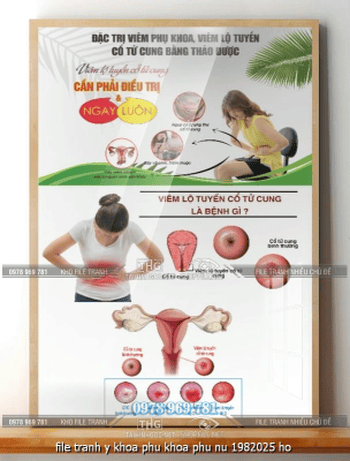 file tranh y khoa phu khoa phu nu 1982025 ho