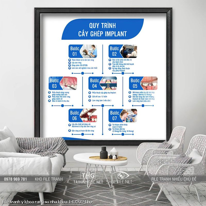 file tranh y khoa rang su nha khoa 1432024 ho