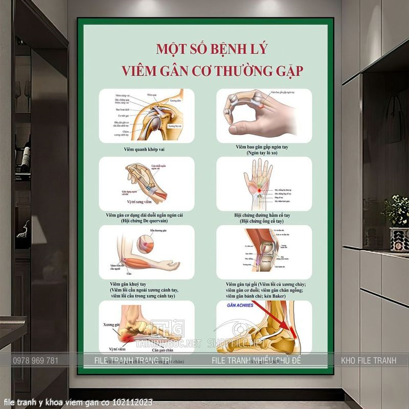 file tranh y khoa viem gan co 102112023