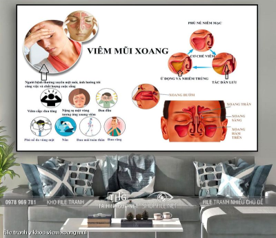file tranh y khoa viem xoang mui