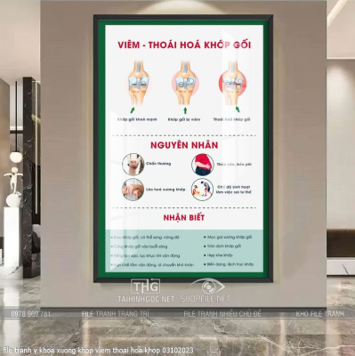 file tranh y khoa xuong khop viem thoai hoa khop 03102023
