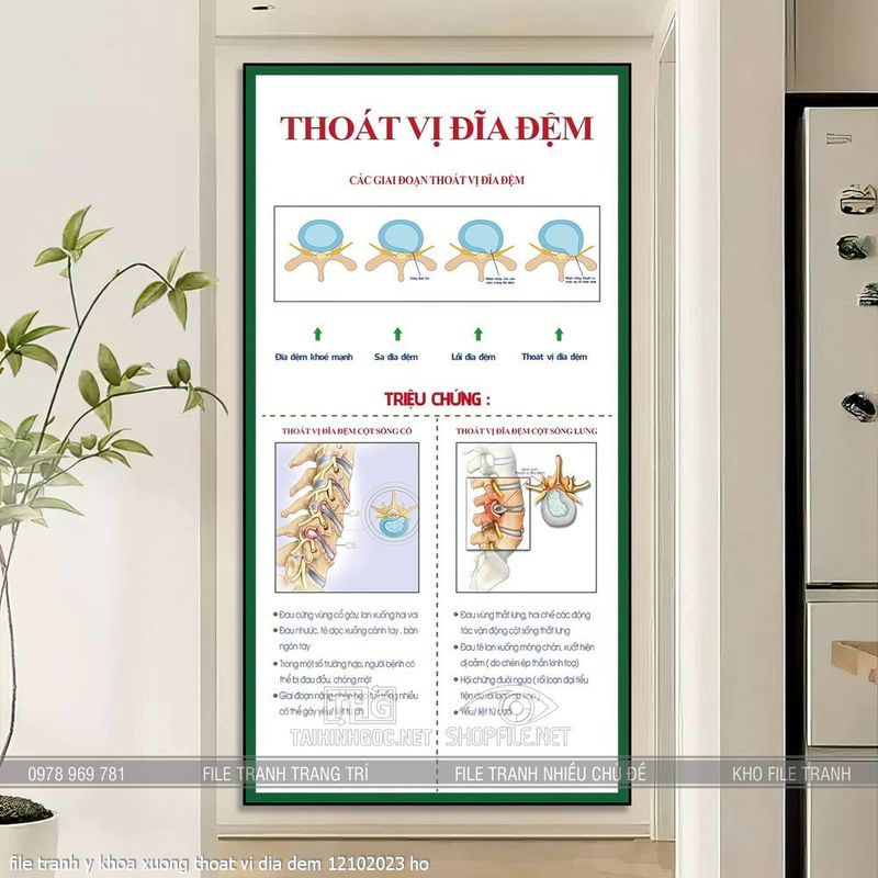 file tranh y khoa xuong thoat vi dia dem 12102023 ho