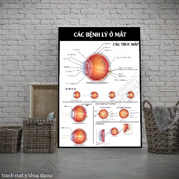 tranh nhan khoa mat y khoa