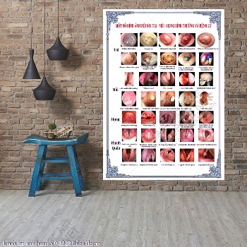 tranh y khoa tai mui hong 5 9 2022 thien